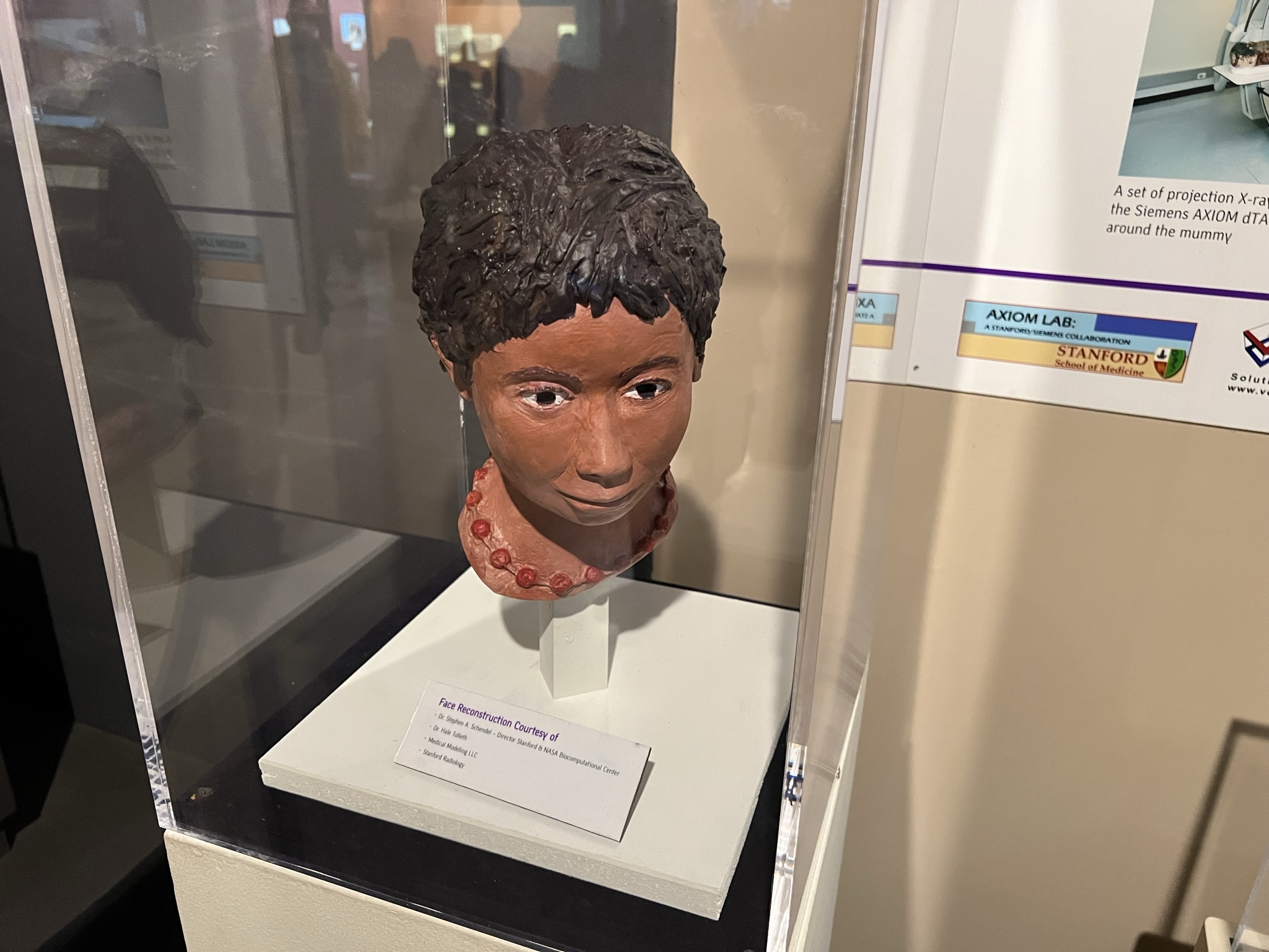 甚至还有脸部重建